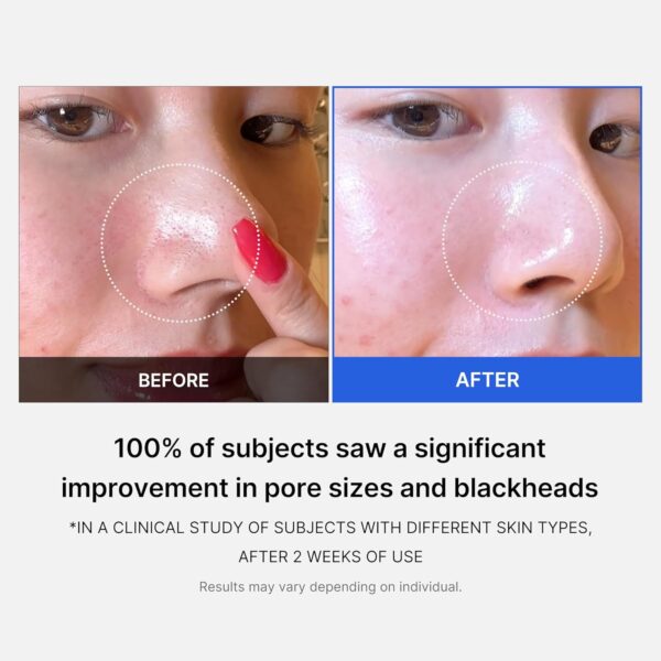 Limited time deal 52% off Medicube Zero Pore Pads - Image 3