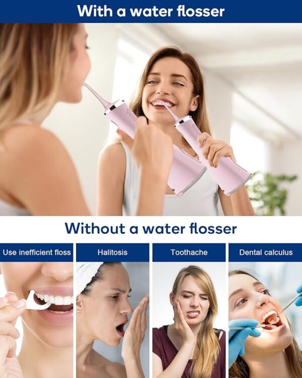Limited time deal 5% off Water Flossers for Teeth - Image 3