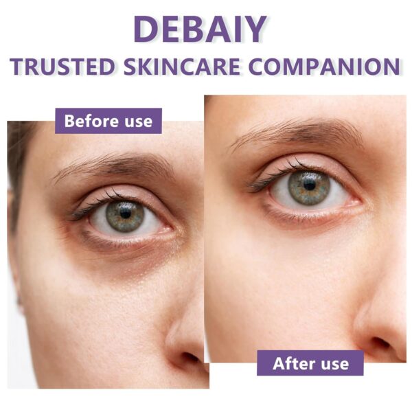 Limited time deal 10% off Eye Cream - Image 3