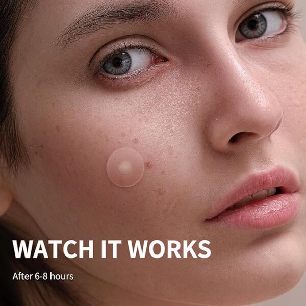Limited time deal 23% off Pimple Patches - Image 3