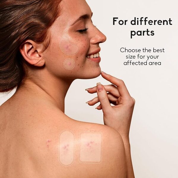 Limited time deal 23% off Pimple Patches - Image 2